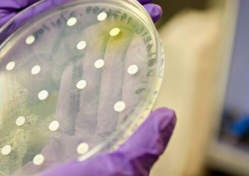 Culture bactérienne pour diagnostiquer la prostatite