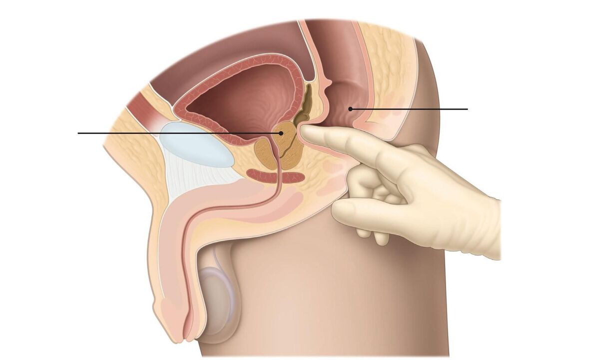 Technique de massage de la prostate